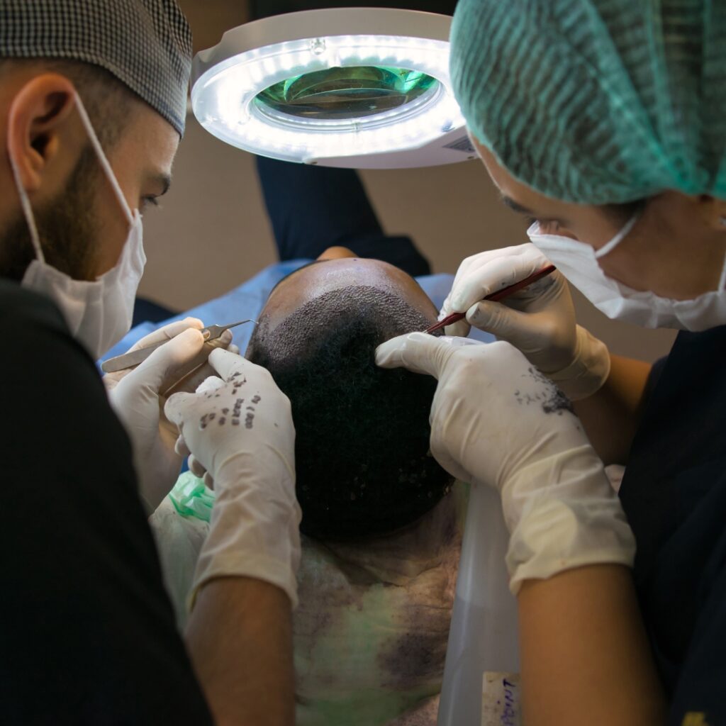 Hårtransplantation i Malmö hos Maxo Klinik