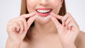 Invisalign Malmö – Maxo Klinik